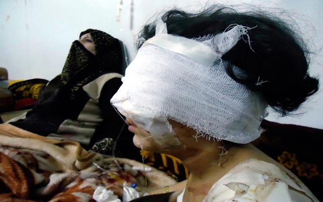 الصورة: طفلة أصيبت بجروح خلال قصف حي باب عمرو بحمص في 6 فبراير 2012. رويترز