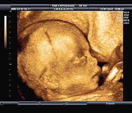 الحرب الكبرى من أجل الحضارة