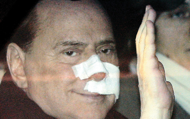 برلسكوني يخضع لجراحة تجميلية في وجهه