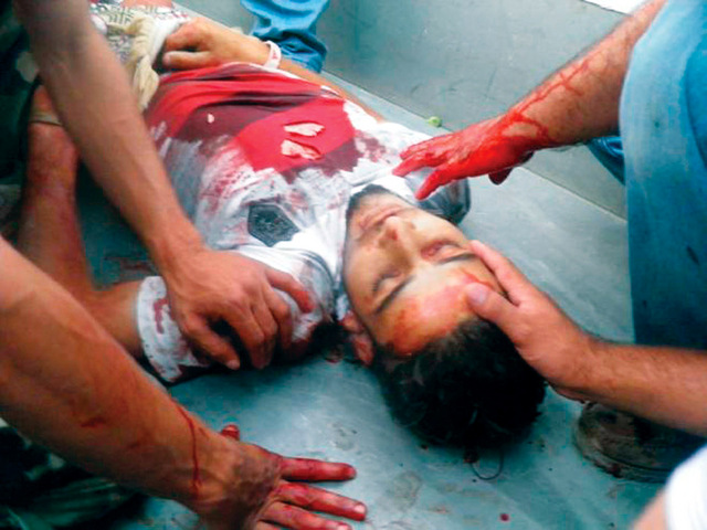 "محاولة إسعاف أحد جرحى القصف المدفعي في إحدى قرى حمص"