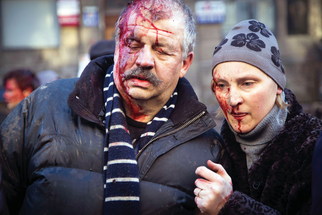 "متظاهران أوكرانيان ينزفان بعد إصابتهما في الاحتجاجات\t أ.ف.ب"