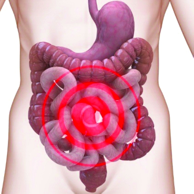 "الغازات تتجمع داخل الأمعاء الغليظة"