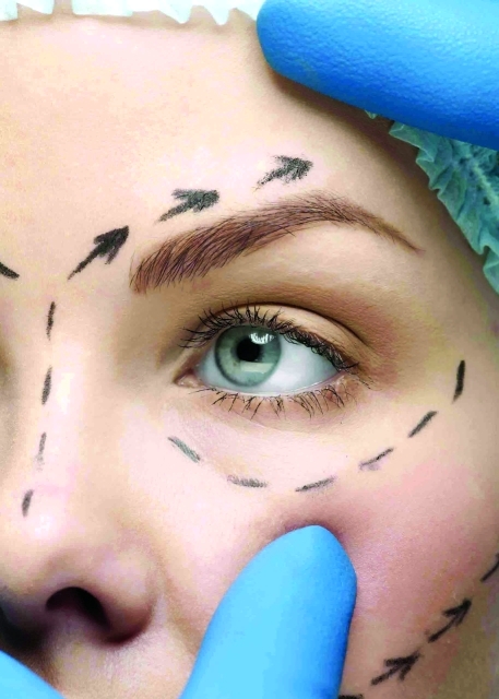 "أكثر من 23 مليون عملية تجميل"