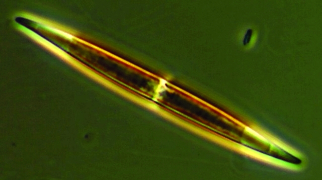 "■ صورة مقربة للخلايا المسببة للطحالب | رويترز"