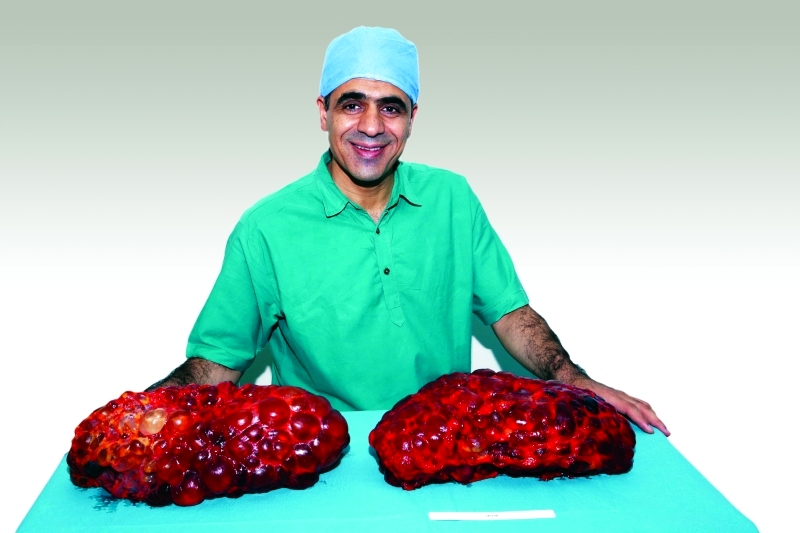 "■ د. فريبرز باقري مع الكليتين | من المصدر"