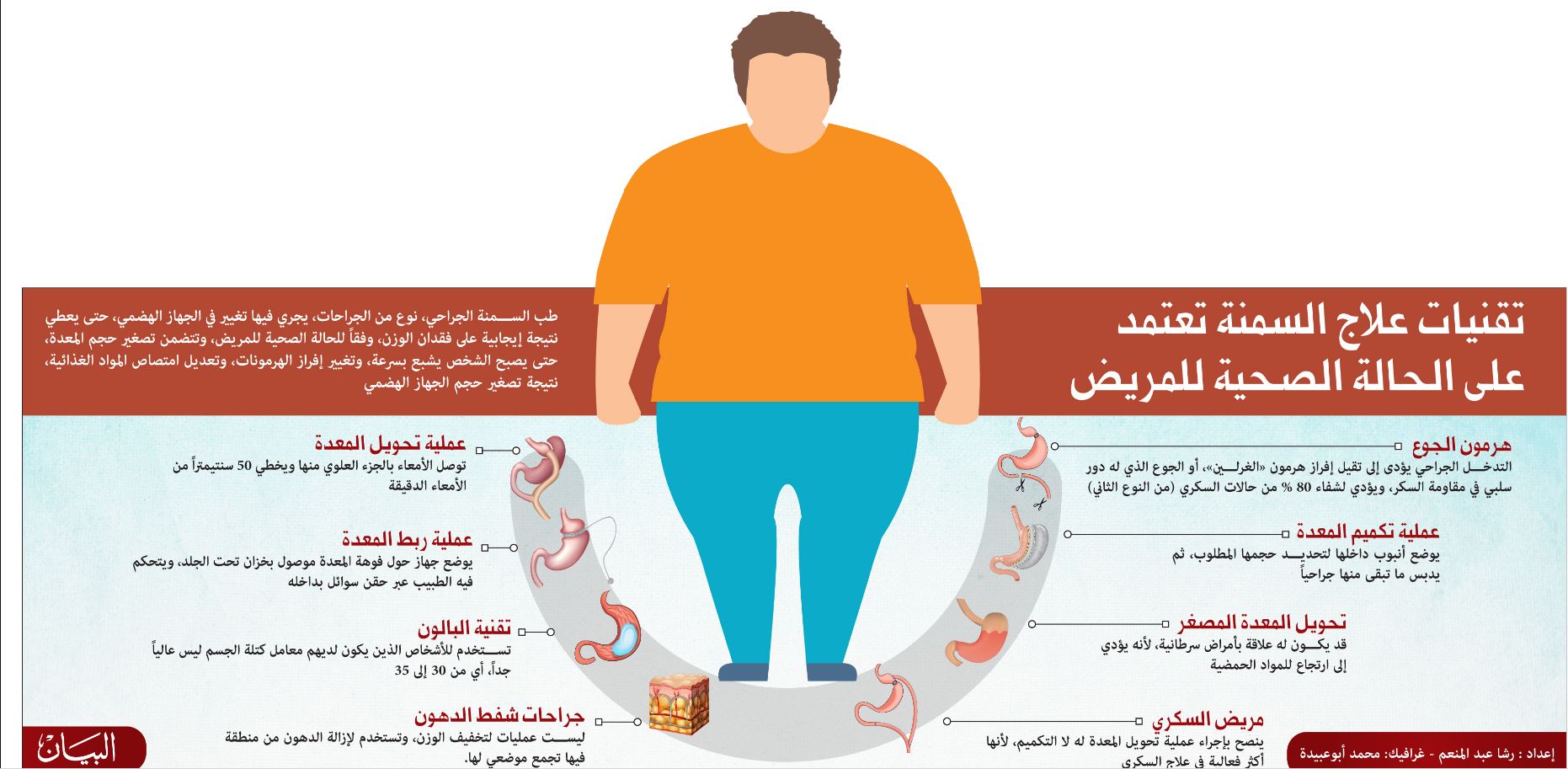 الوزن الزائد..آلام وخزات التجميل ونظرة المجتمع