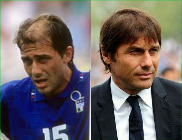 كونتي.. "فنان الباروك" الذي ضل طريقه إلى الملاعب