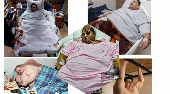 بالصور.. أشهر 5 ضحايا للسمنة حول العالم