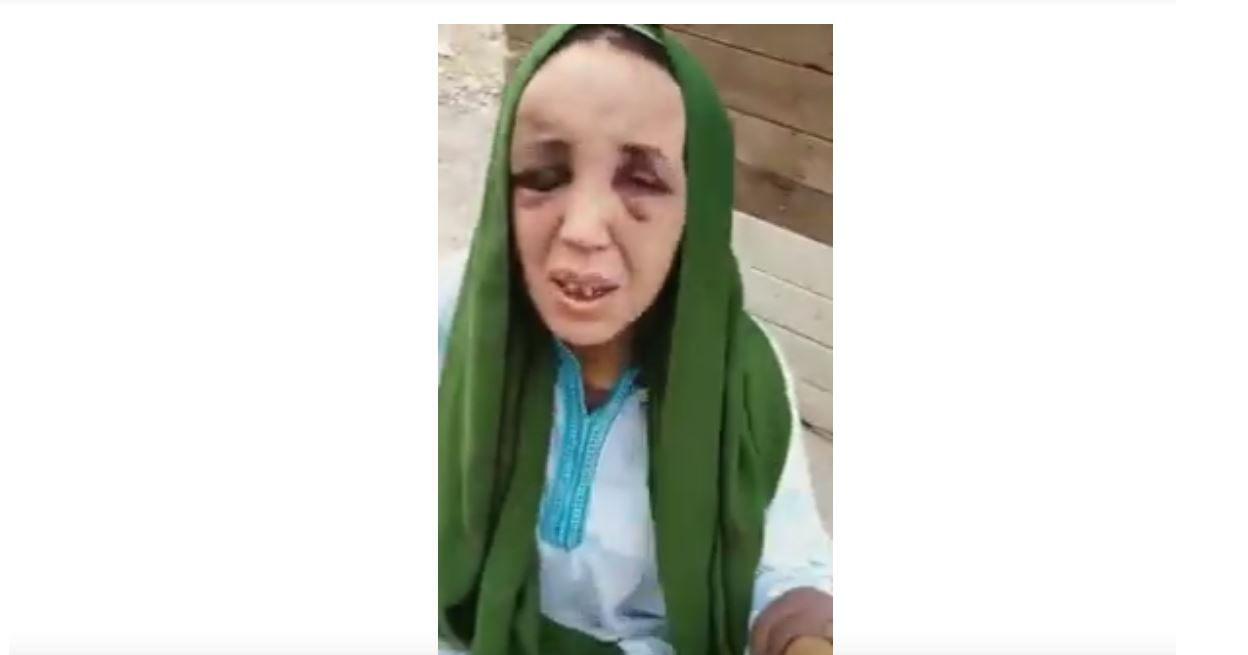 فيديو امرأة ضربها زوجها بوحشية يهز مواقع التواصل