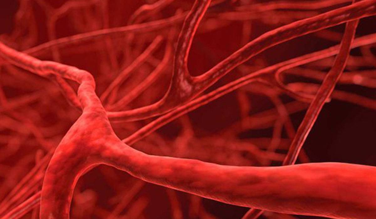ما العلاقة بين حالة الأوعية الدموية والسرطان؟