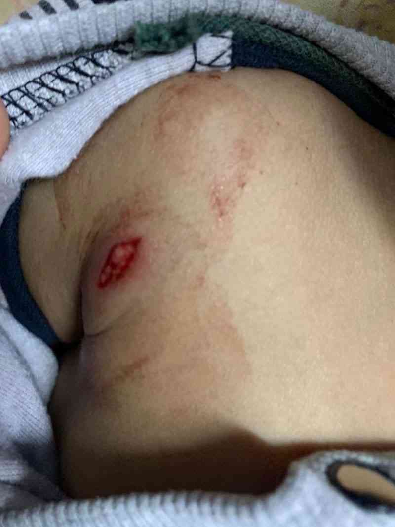 "رصاصة طائشة" بحفل زواج تستقر في صدر رضيع