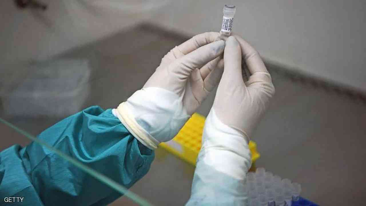 لقاح «كورونا الروسي» يشعل حرباً في المختبرات العالمية