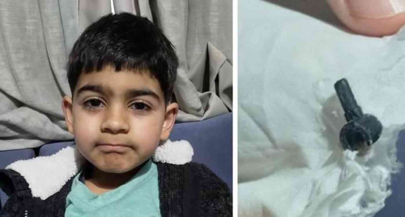 العثور على قطعة ليغو مفقودة منذ عامين في أنف طفل