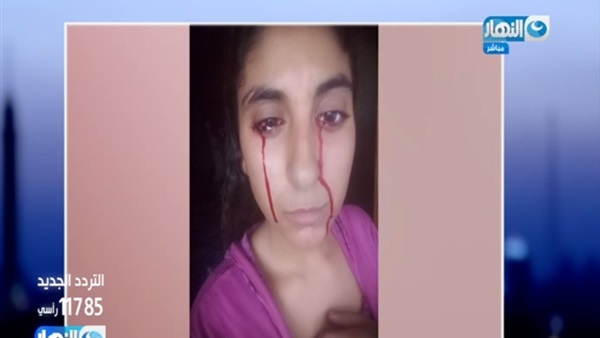 أغرب من الخيال.. فتاة مصرية يخرج الدم من عينيها وفمها وأنفها