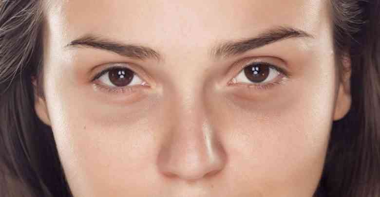 الهالات السوداء تشير إلى أمراض خطيرة