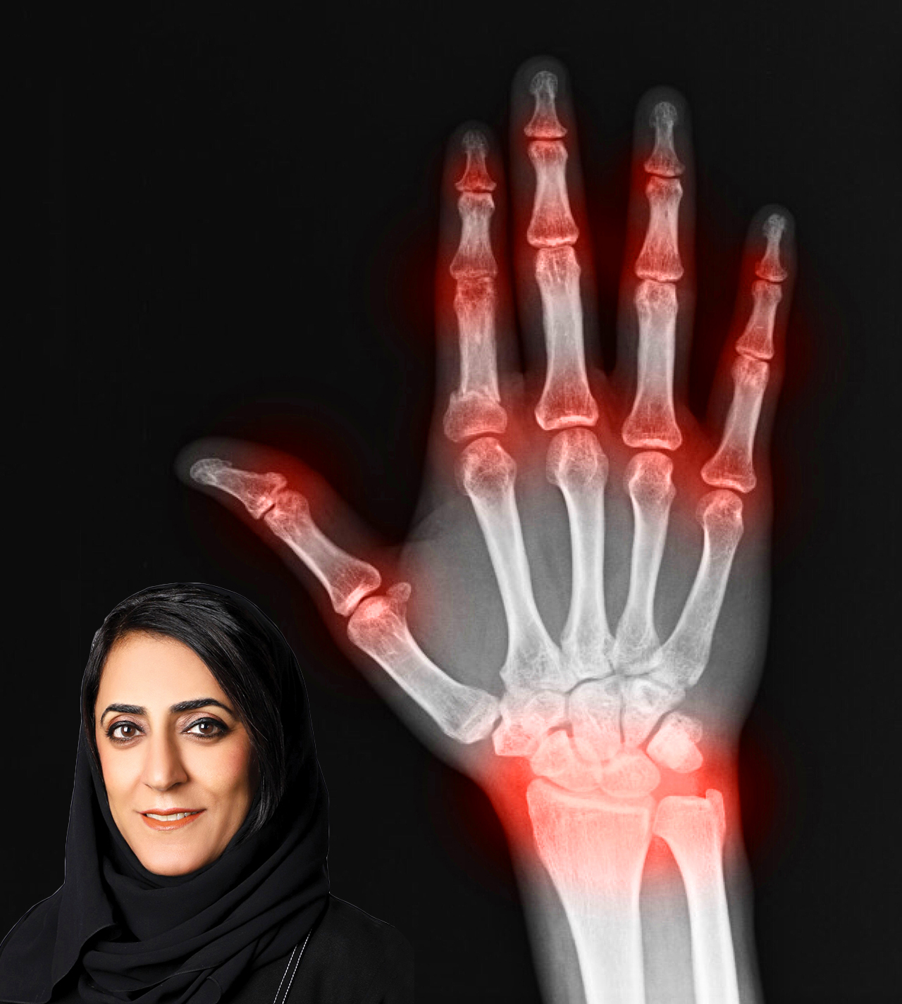 4 بحوث لـ«الصحة» في مؤتمر الجمعية الأوروبية
