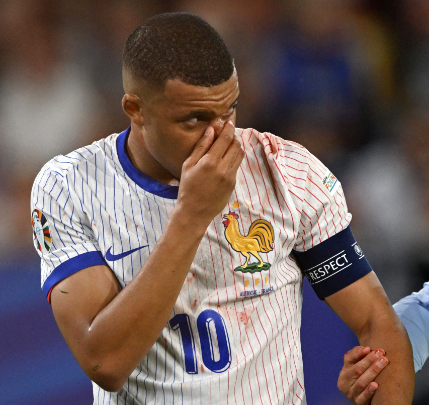 "كسر أنف مبابي أبرز مشاهد «يورو 2024» | أ ف ب"