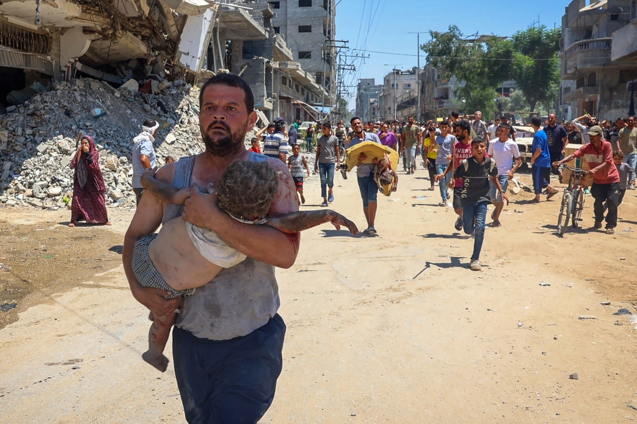 غزة بين شلل الأطفال وشلل المنظومة الصحية