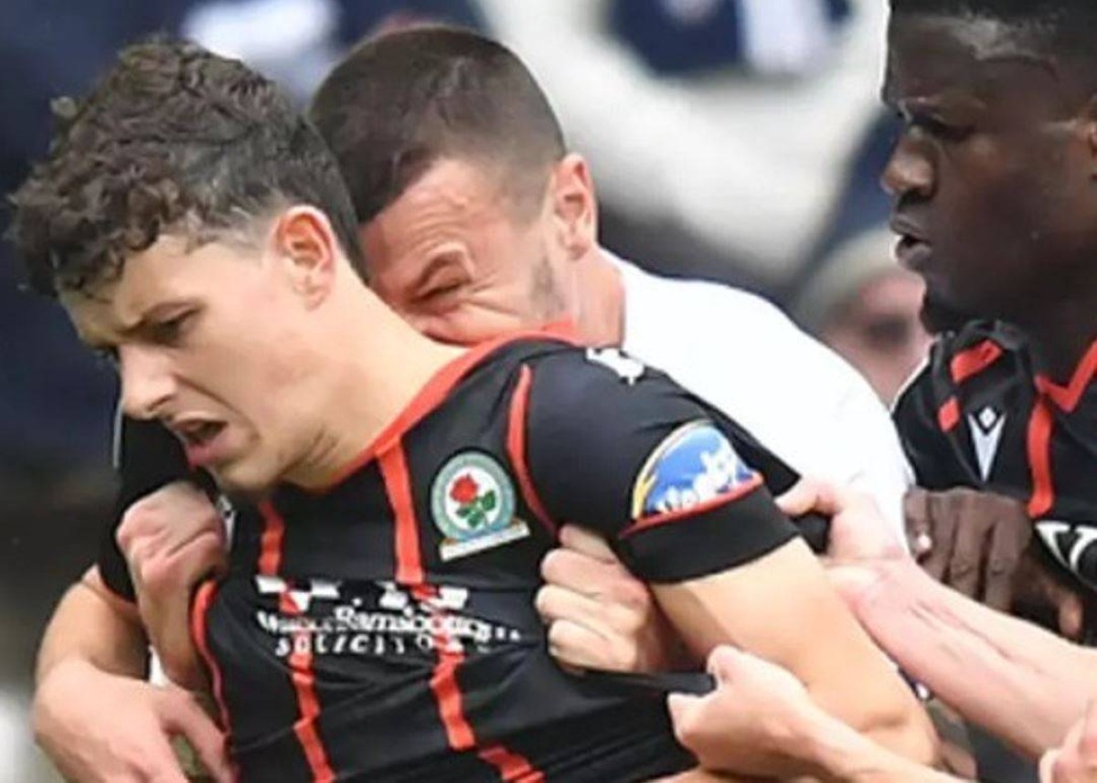 إيقاف لاعب بريستون نورث إند ثماني مباريات بعد عضه لمدافع بلاكبيرن