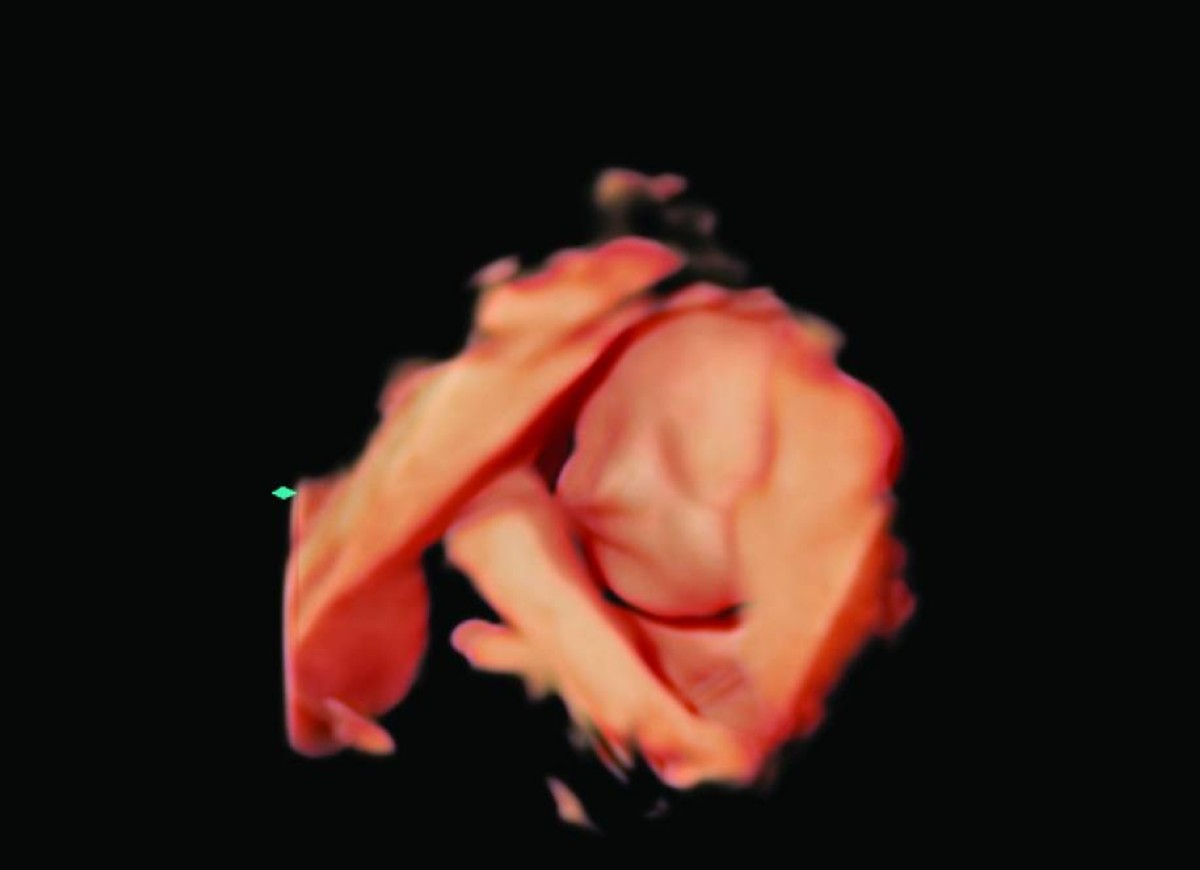 صورة بيل سميث