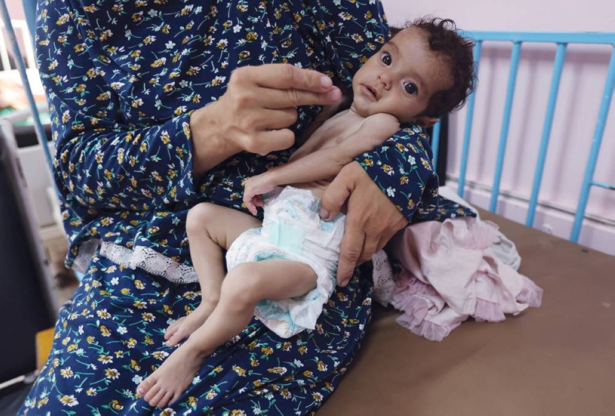 فلسطينية تحتضن طفلتها التي تعاني من سوء التغذية في مستشفى ناصر بمدينة خان يونس