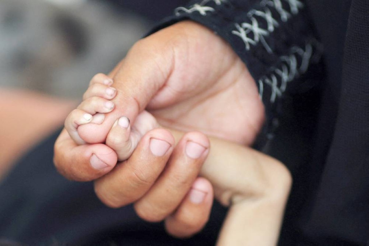 فلسطينية بمدينة غزة تمسك بيد طفلها البالغ 5 أشهر يعاني من سوء التغذية