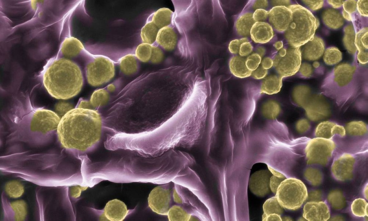 فطر يحوّل جزيئات الذهب إلى كنز على خيوطه