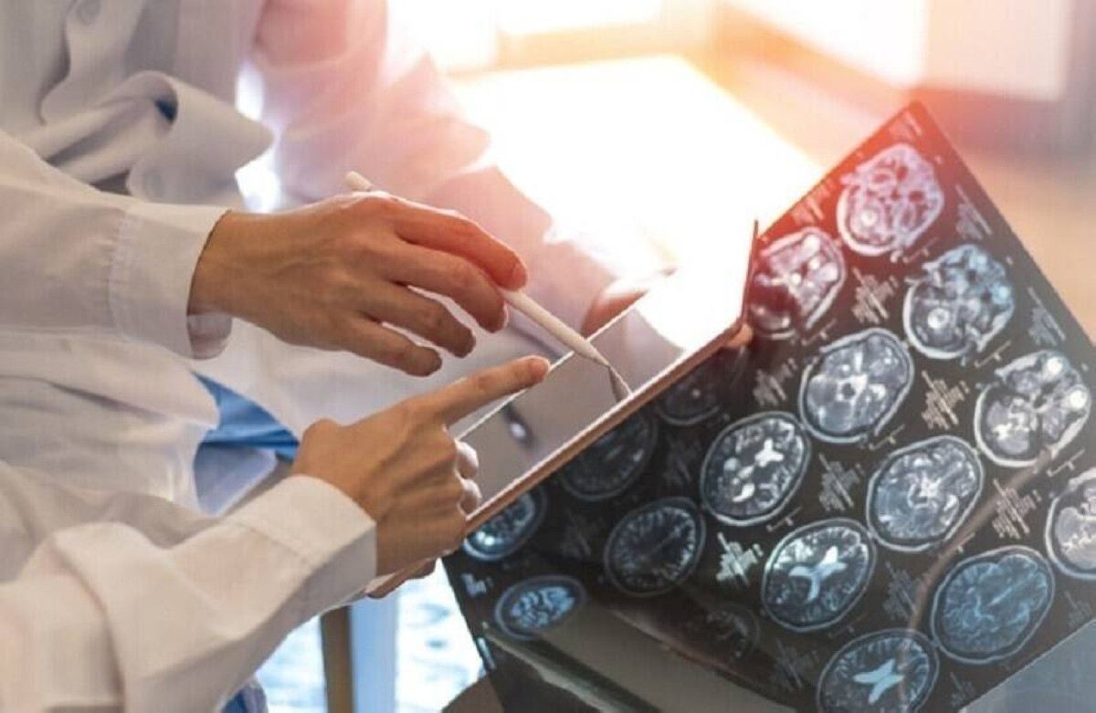 أداة تكتشف سرطان الدماغ