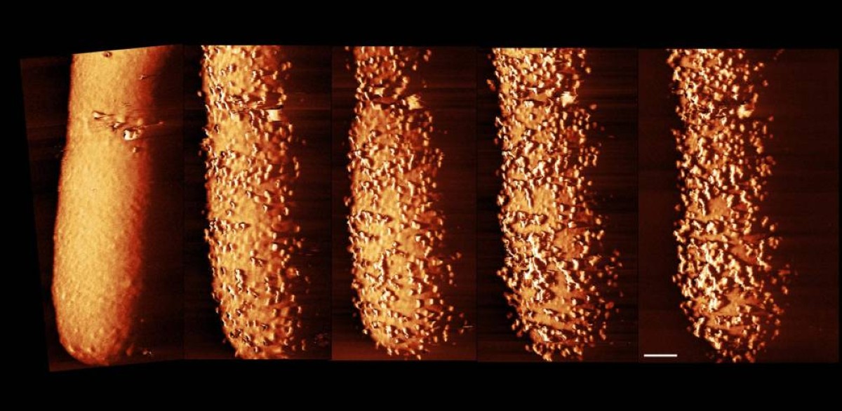 صور مركبة تظهر تأثير المضاد على البكتيريا