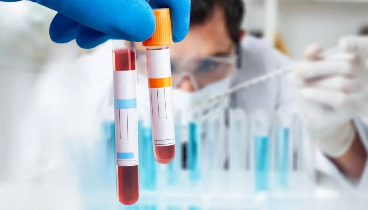 بدقة عالية.. اختبار دم متطور يكشف الإصابة بمتلازمة التعب المزمن