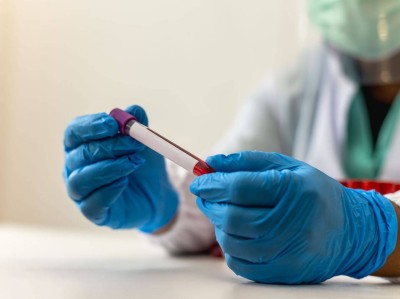 علماء يبتكرون تقنية تعزز فعالية علاج سرطان الدم ثمانية أضعاف