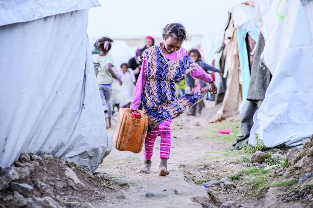 80 % من اليمنيين يفتقرون للغذاء الكافي والمياه النظيفة