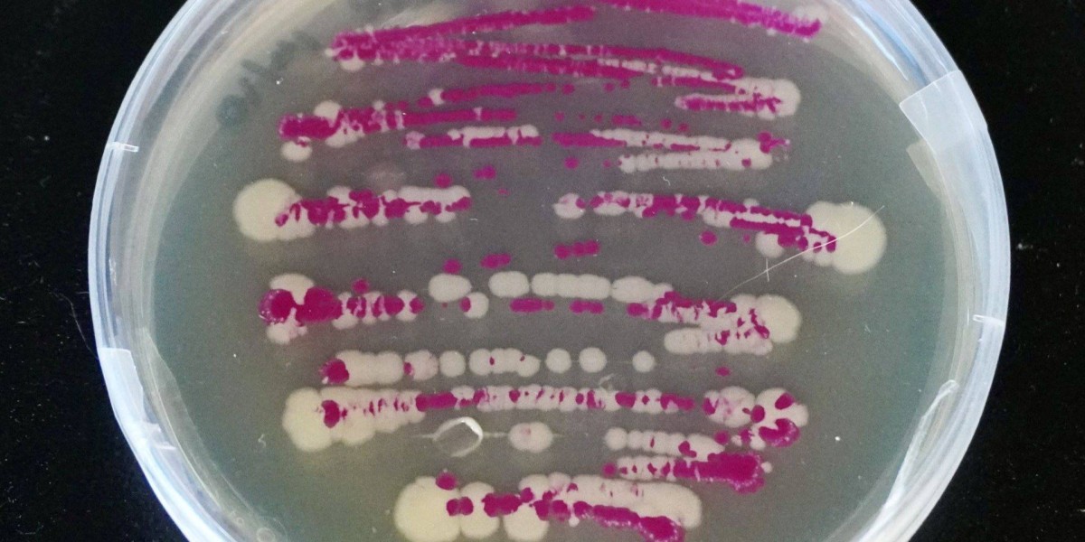 أغرب طريقة للبقاء.. بكتيريا تتظاهر بالموت