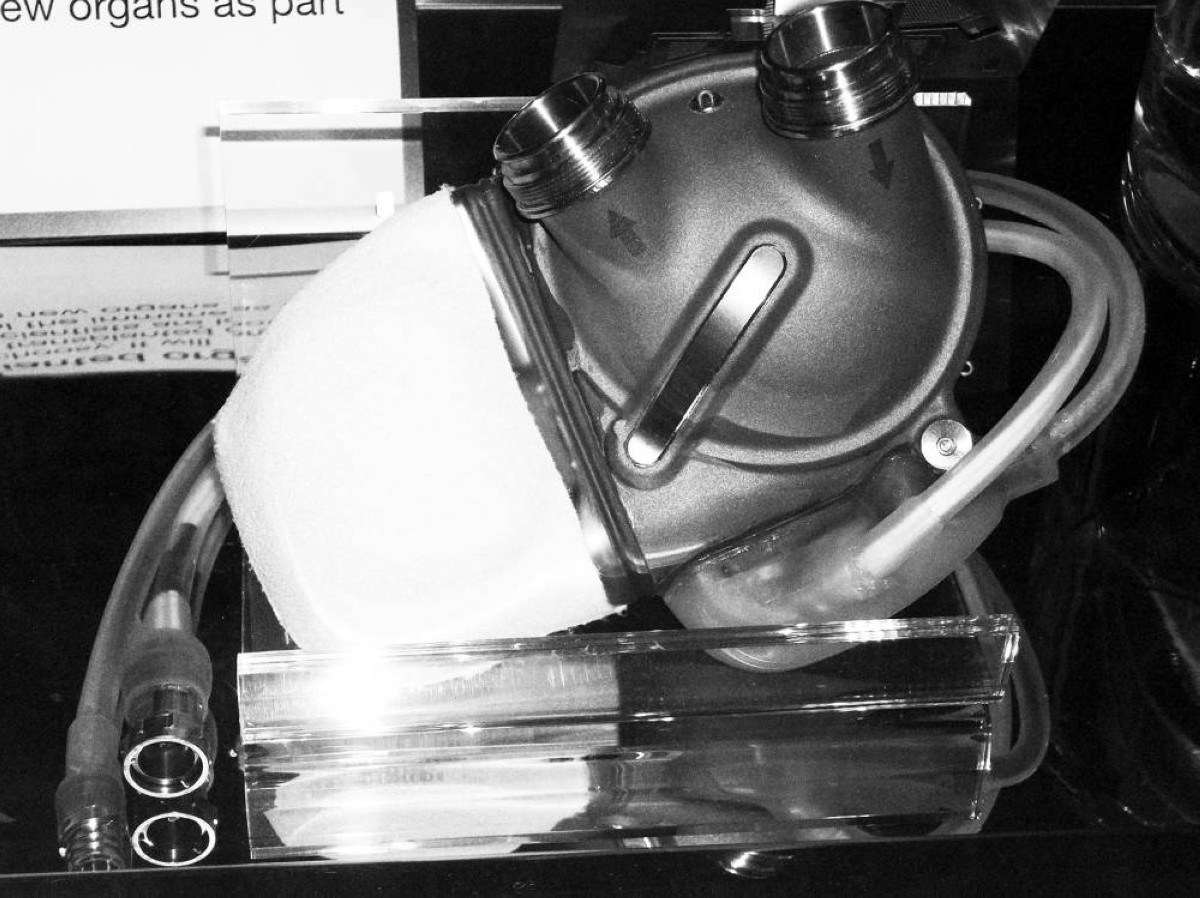 2013 - أول عملية زرع قلب صناعي في التاريخ تتم بمستشفى جورج بومبيدو الأوروبي في باريس.