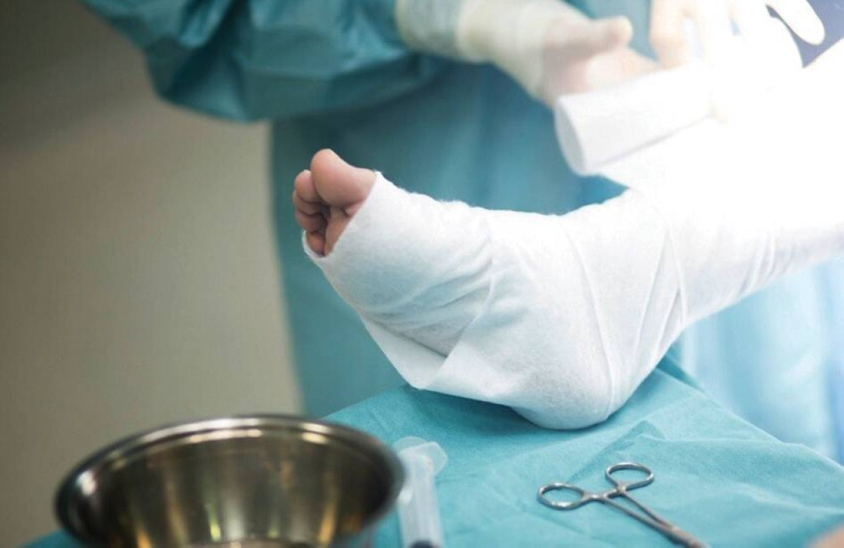 نجاح زراعة طرف اصطناعي