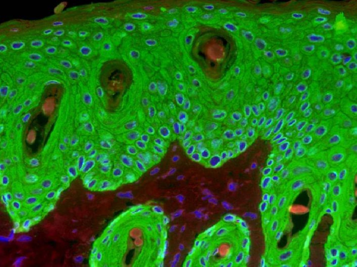 ابتكار أسلوب يحوّل الخلايا الجذعية إلى مؤشرات ضوئية للتوتر والالتهاب