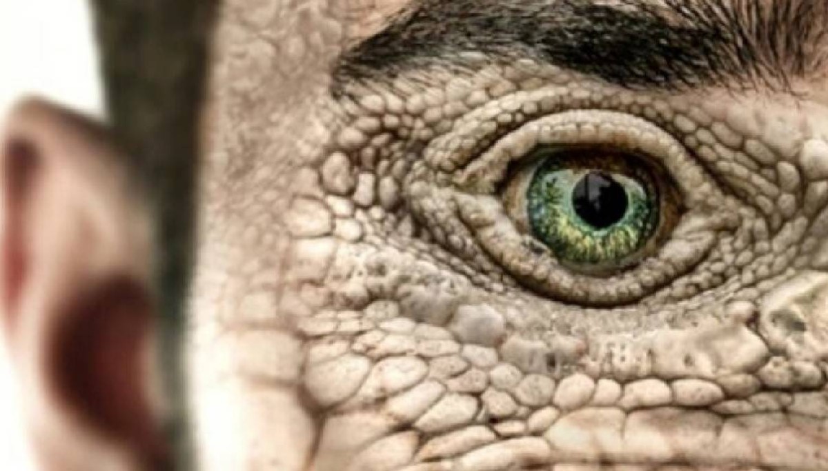 واحدة من 80 حالة فقط في العالم.. امرأة ترى البشر وحوشاً شيطانية