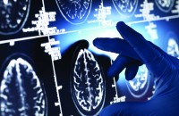 طريقة تحارب الزهايمر