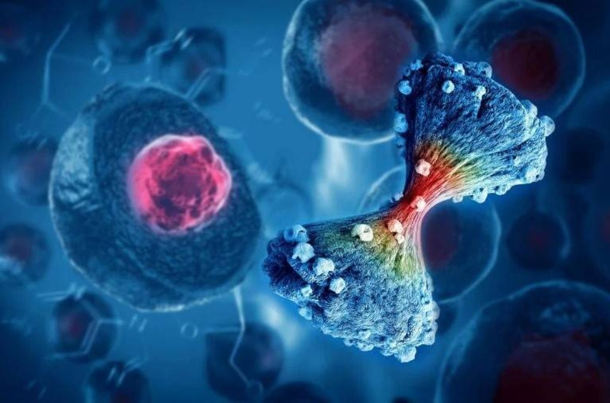 الذكاء الاصطناعي يكشف سر انتشار السرطان