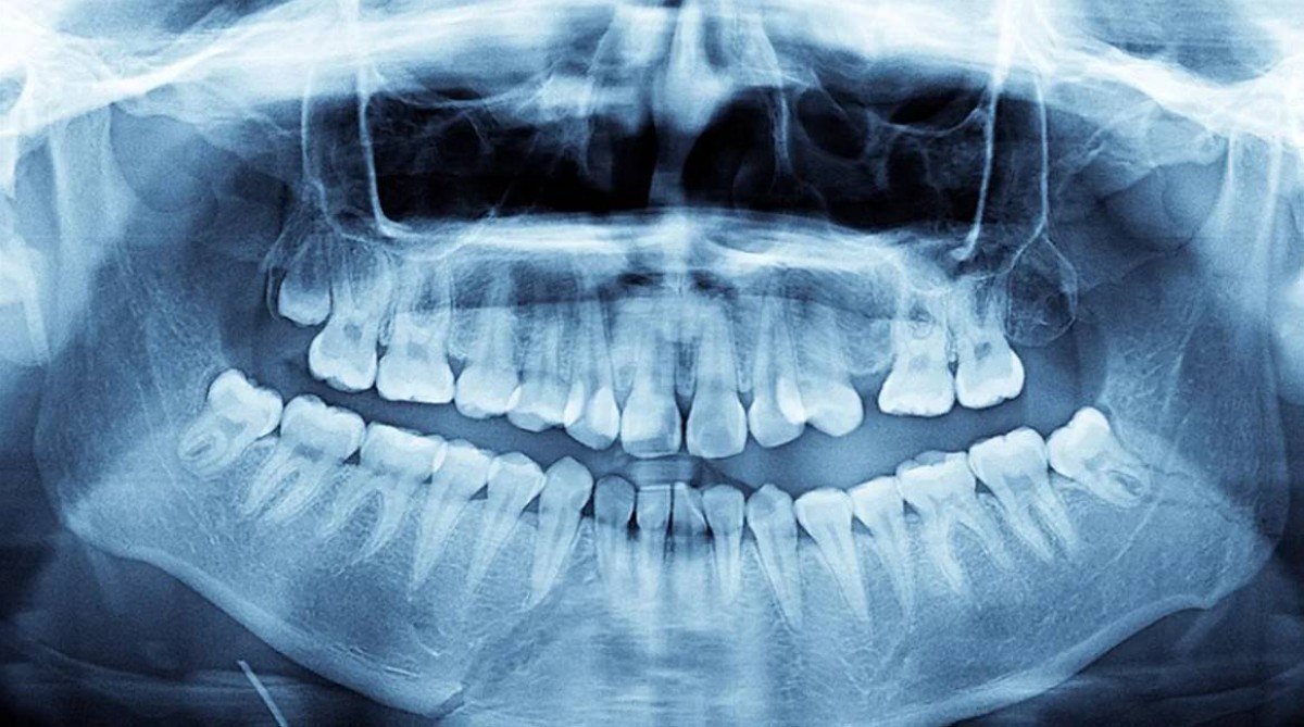 42 سناً دون أن يعلم.. رجل  يسجل رقماً في غينيس بابتسامة لا مثيل لها