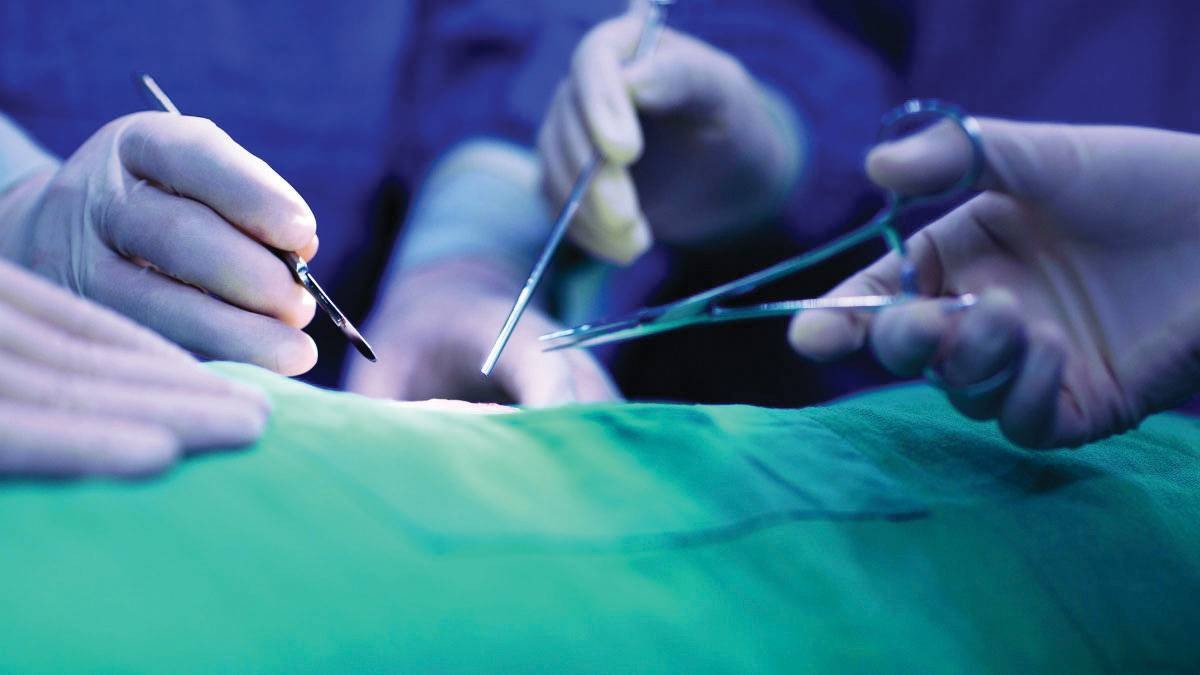 إنجاز صيني في زراعة الأعضاء