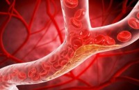 حبوب جديدة تخفض الكوليسترول الضار 60% ويعيد الأمل لملايين مرضى القلب