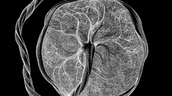 "لا أحد يعرف ماهيتها".. اكتشاف نوع من الخلايا لا يُرى إلا أثناء الحمل