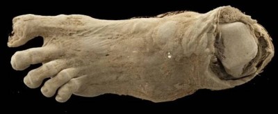 أسرار لم تُروَ من قبل.. ما الذي كشفته الأشعة داخل أجساد الفراعنة المحنطة؟