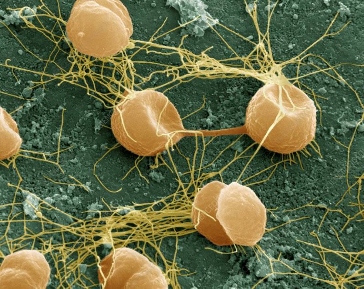 "بيروكوكوس"… حياة عند حافة الغليان