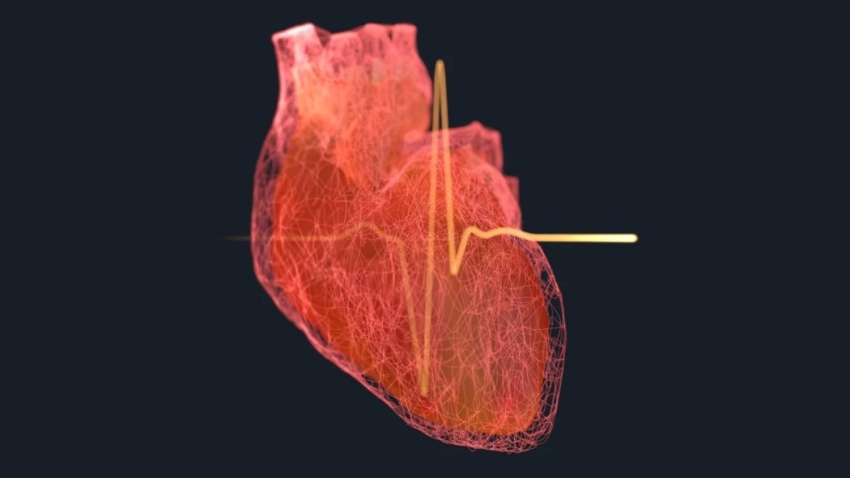 99% of Heart Attacks and Strokes Linked to 4 Key Risk Factors