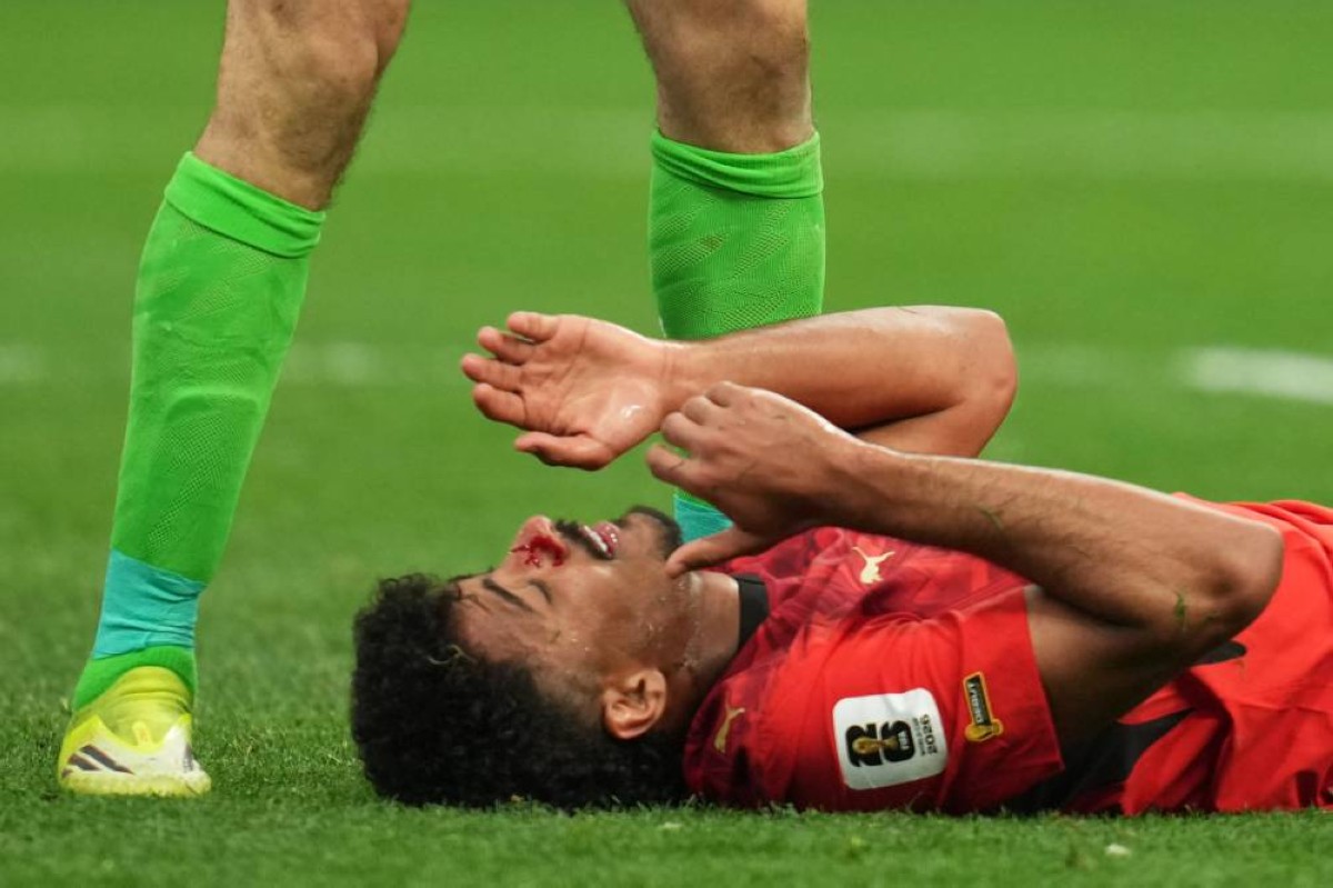 إصابة عبد المجيد تفعّل التبديل الاستثنائي للفراعنة في المونديال