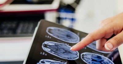 سر نجاة بعض أدمغة البشر من التحلل بعد الموت