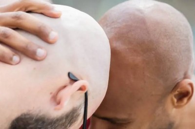 أدوية الصلع «منجم ذهب» وول ستريت