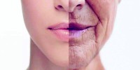خلايا هرمة